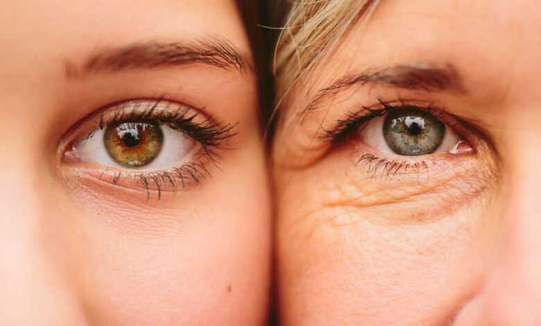 Facts About Upper and Lower Eyelid Surgery in New York City, NY