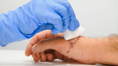 Wound Care