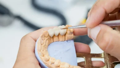 The Cost of Dental Crowns Is It Worth the Investment?