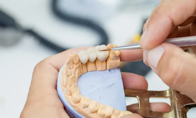 The Cost of Dental Crowns Is It Worth the Investment?