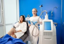 CoolSculpting