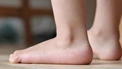 How to Treat Flat Feet in Children and Adults