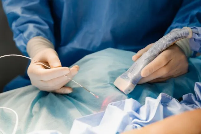 Varicose Veins Is Surgery the Best Option for Treatment? Varicose Veins Is Surgery the Best Option for Treatment?