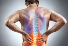 Sciatica Causes Pain