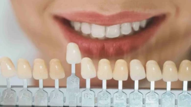 How Veneers Can Help Address Gaps and Chips in Teeth