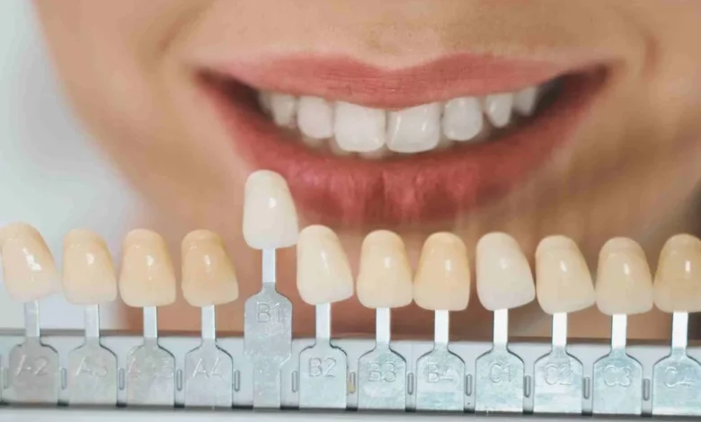 How Veneers Can Help Address Gaps and Chips in Teeth