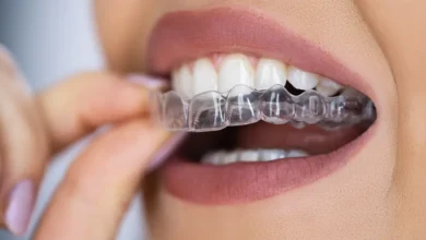 What to Expect During Your First Week With Invisalign