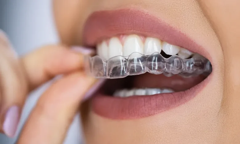 What to Expect During Your First Week With Invisalign What to Expect During Your First Week With Invisalign