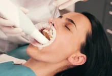 Dental Cleaning and Its Role in Preventing Tooth Decay