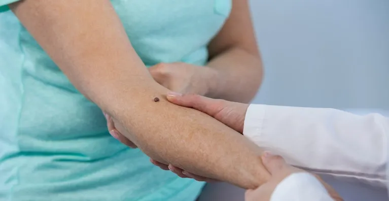 Signs You Need to See a Dermatologist Signs You Need to See a Dermatologist