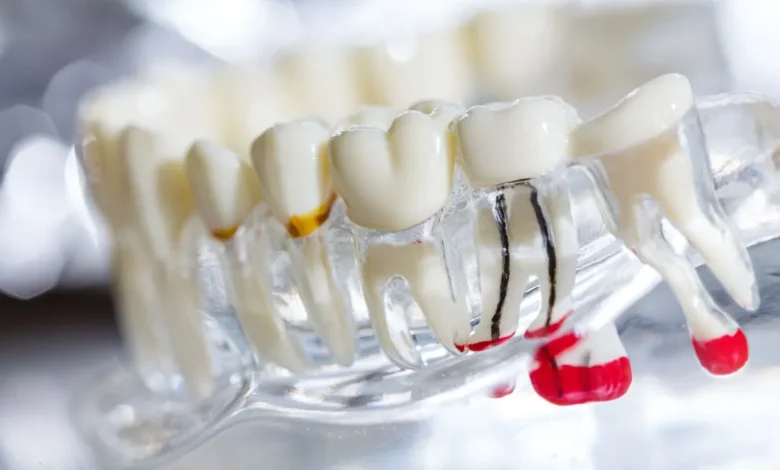The Importance of Root Canals for Saving Damaged Teeth The Importance of Root Canals for Saving Damaged Teeth