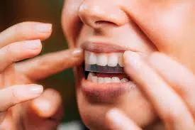 Teeth Whitening What’s the Best Option for Your Lifestyle? Teeth Whitening What’s the Best Option for Your Lifestyle?