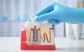 How Dentistry Has Evolved with Advanced Technology How Dentistry Has Evolved with Advanced Technology