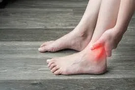 How to Recognize and Treat Common Ankle Injuries How to Recognize and Treat Common Ankle Injuries