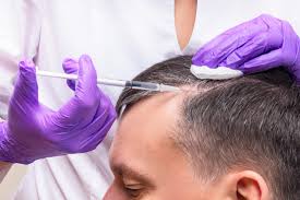 PRP Hair Restoration: How Does It Work? PRP Hair Restoration