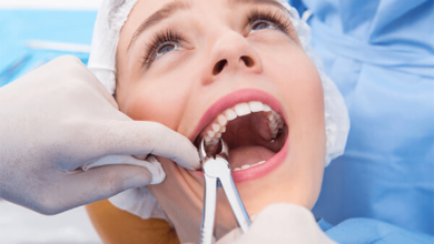 Dental Extraction