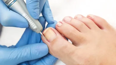 The Hidden Causes of Ingrown Toenails and How to Prevent Them