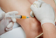 PRP Injections