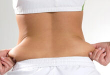 Liposuction vs. Liposculpture